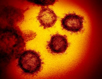 Transmission electron microscope image of SARS-CoV-2, the virus that causes COVID-19, emerging from human cells.