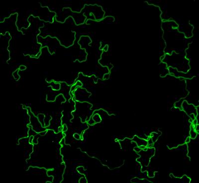 Micrograph of the Lyme disease spirochete Borrelia burgdorferi