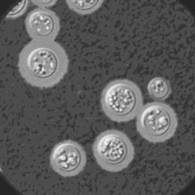 The fungus Cryptococcus neoformans