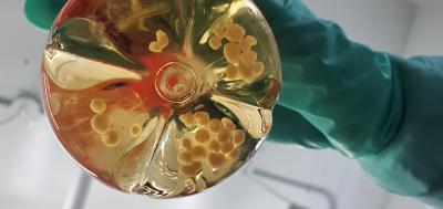 A researcher holds a glass flask containing small spherical human cerebral organoids similar to those used in the CWD study