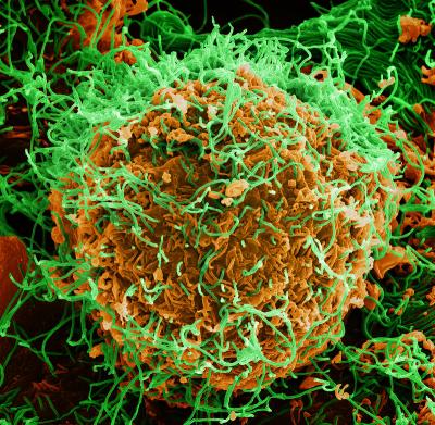 colorized scanning electron micrograph of Ebola virus particles (green) on the surface of infected cells (orange).