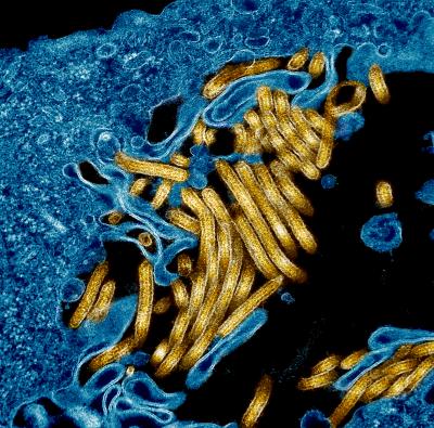 Microscopic view of gold, filament-shaped viruses clustered against a mass of blue tissue on a black background.  