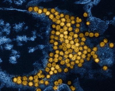 Yellow enterovirus particles and blue cells on a black-colored background.