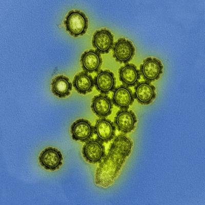 influenza virus particles, showing their round shape and bumpy surface proteins.