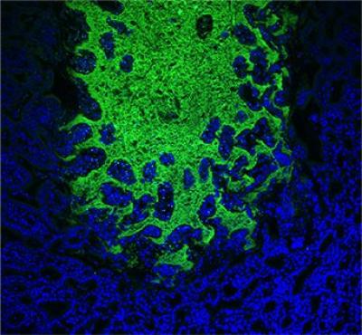 Visualization and localization of commensal bacteria by Fluorescence in situ Hybridization (FISH) in the small intestine of Toxoplasma gondii-infected mice.