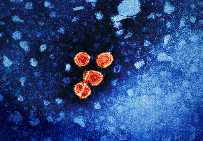 Image of Hepatitis B virus particles