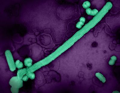 Teal influenza A virus particles—as filaments and spheres—on a purple background.