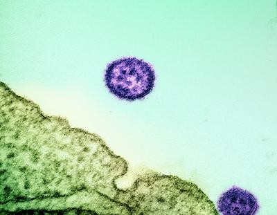 A colorized transmission electron micrograph showing two, small round objects (mature Lassa virus particles) outside of a cell.