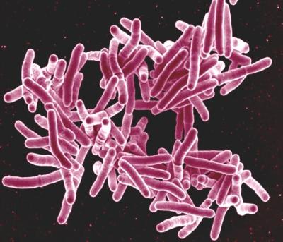 micrograph of Mtb bacteria