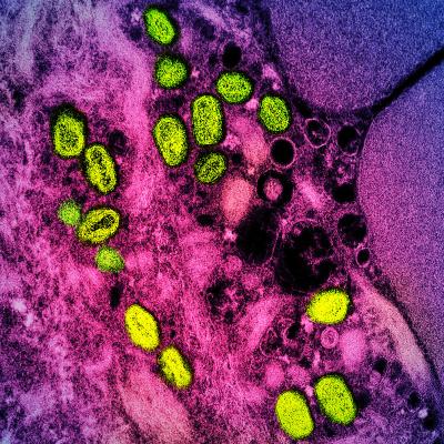 Monkeypox particles (green) found within an infected cell (pink and purple)