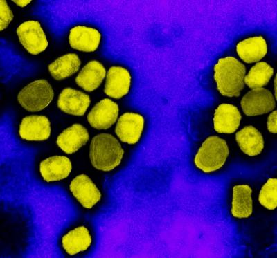 Electron micrograph of mpox virus particles (yellow) cultivated and purified from cell culture.