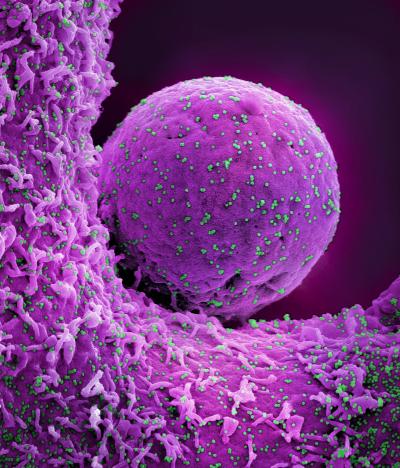 Colorized scanning electron micrograph of a cell infected with the Omicron strain of SARS-CoV-2 virus particles 