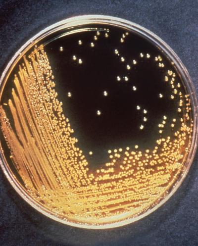 Image of Vibrio cholerae