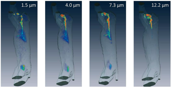 Four PET/CT images of NHPs showing deposition patterns for aerosol particles 1.5, 4.0, 7.3, and 12.2 µm in diameter. The lower concentration shows deeper deposition.