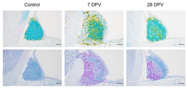 Immunohistochemistry staining of nasal-associated lymphoid tissues (NALT). The upper panels show CD3 (yellow, marking T cells) and PAX5 (teal, marking B cells). The lower panels depict Ki67 (purple, marking proliferating cells).