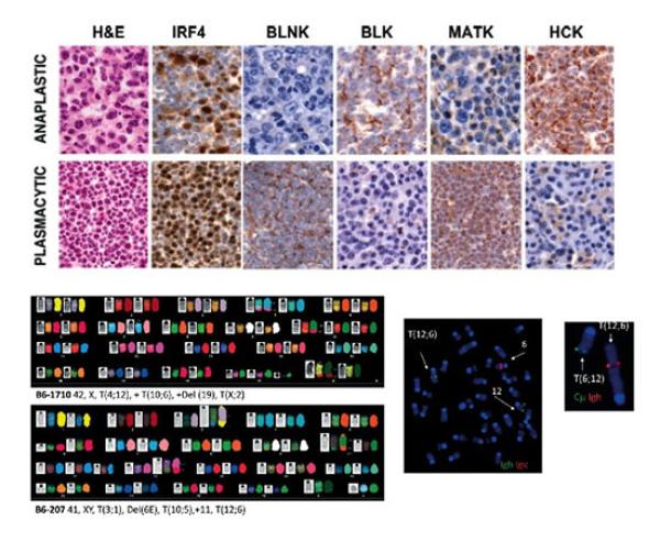 Anaplastic plasmacytomas: relationships to normal memory B cells and plasma cell neoplasms of immunodeficient and autoimmune mice