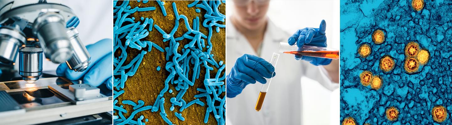 a collage of image, left to right: a close up of a microscope, bacteria, gloved hands pouring fluid into a test tube, viruses and cells.