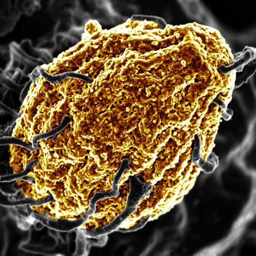 Scanning electron micrograph of phagocytosis of a dead yeast particle (zymosan)