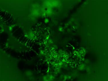 Langat virus infection (bright green) in the tick midgut (black) is shown at six days after infection in this fluorescence image