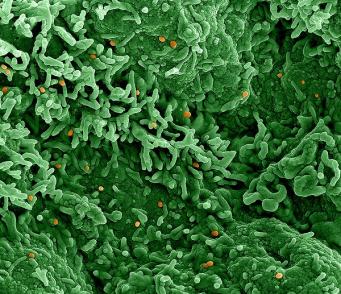 image of mpox virus