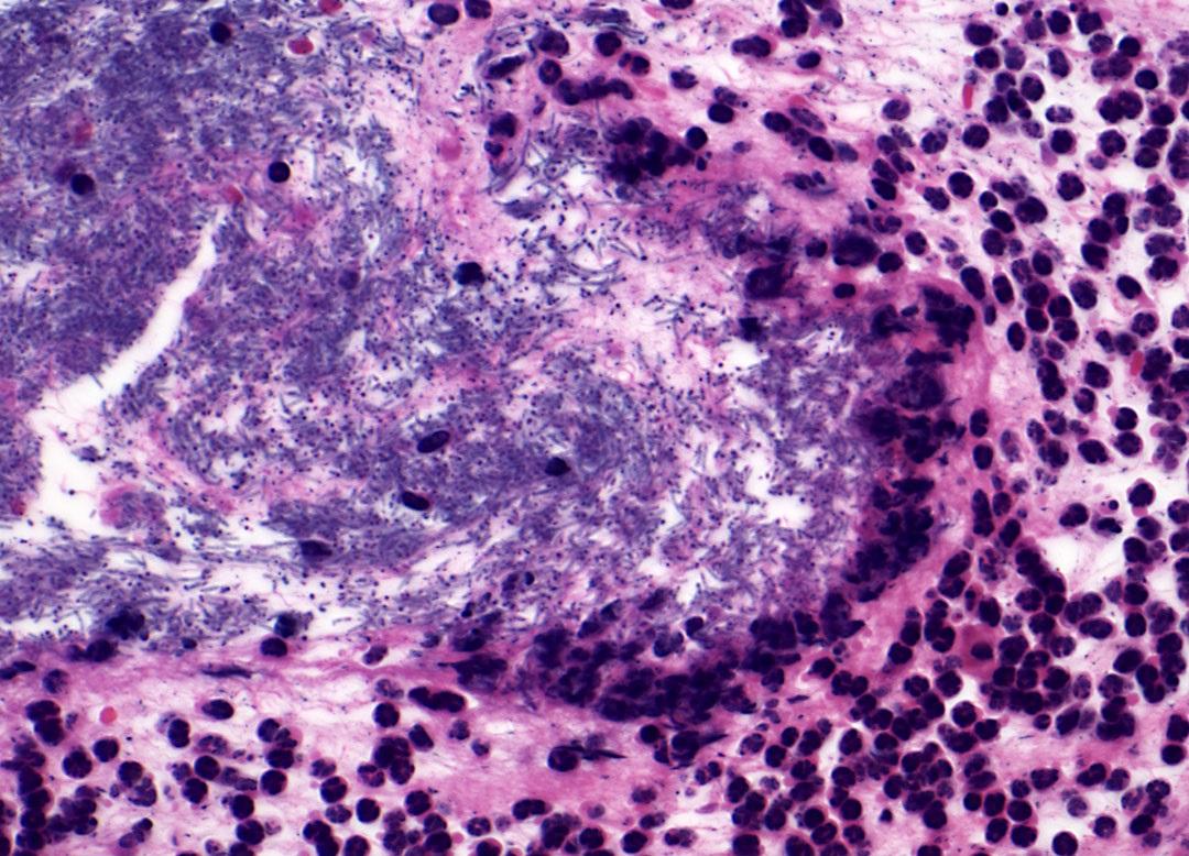 Bacillus anthracis spores and germinated vegetative bacterium vs. the innate immune response in mouse skin. Credit: NIAID