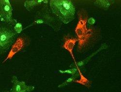 Human dendritic cells infected with LGTV and treated with type I IFN