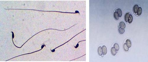 Sperm (left) and embryo cryopreservation (right).