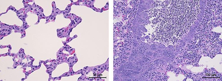 Two slides of histopathology from mock-infected control and infected hamsters indicating interstitial pneumonia