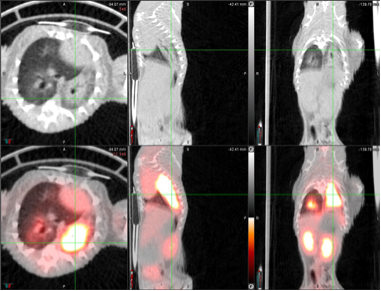 A CT of the lung.