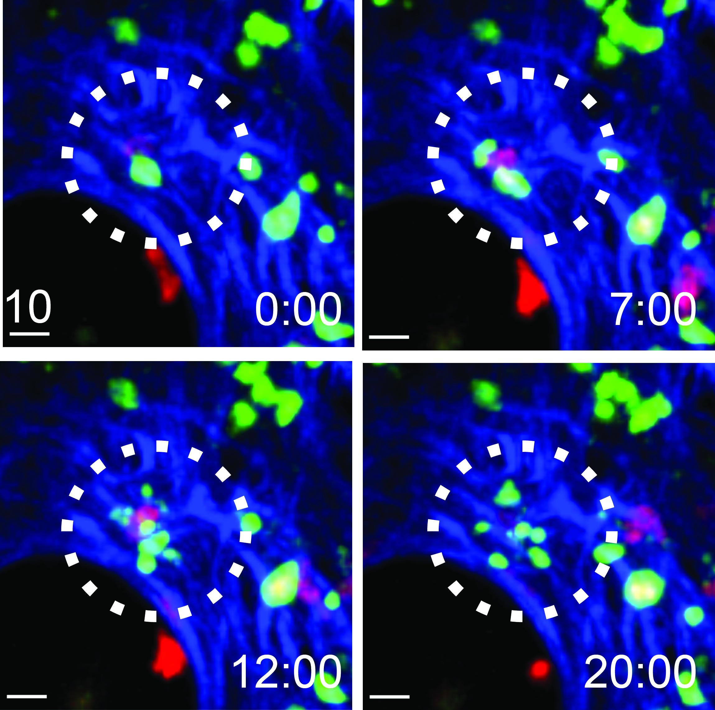 A cytotoxic T cell kills a vaccinia virus-infected cell in the skin 