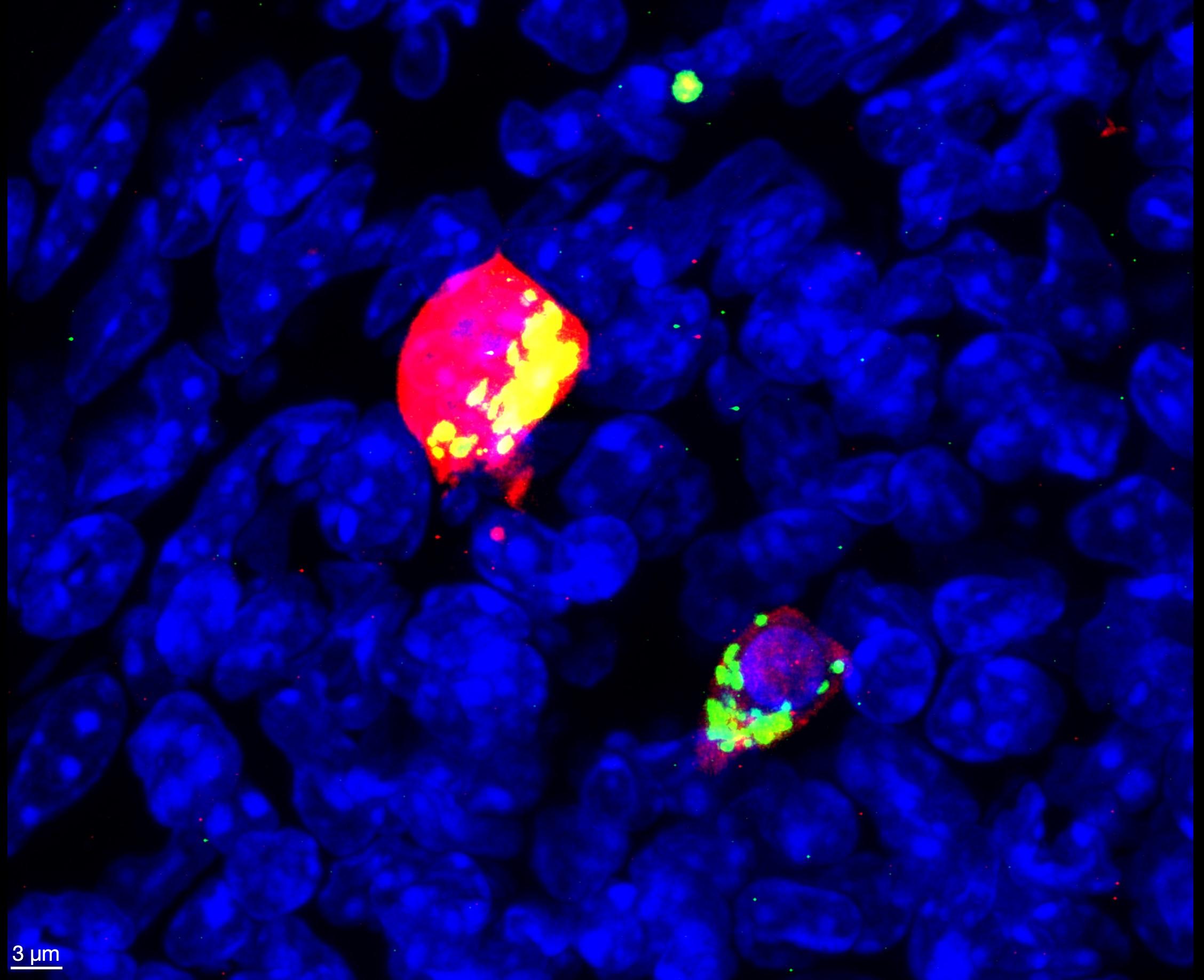 The location and distribution of mitochondria in cytotoxic T cells changes dynamically during infection. 