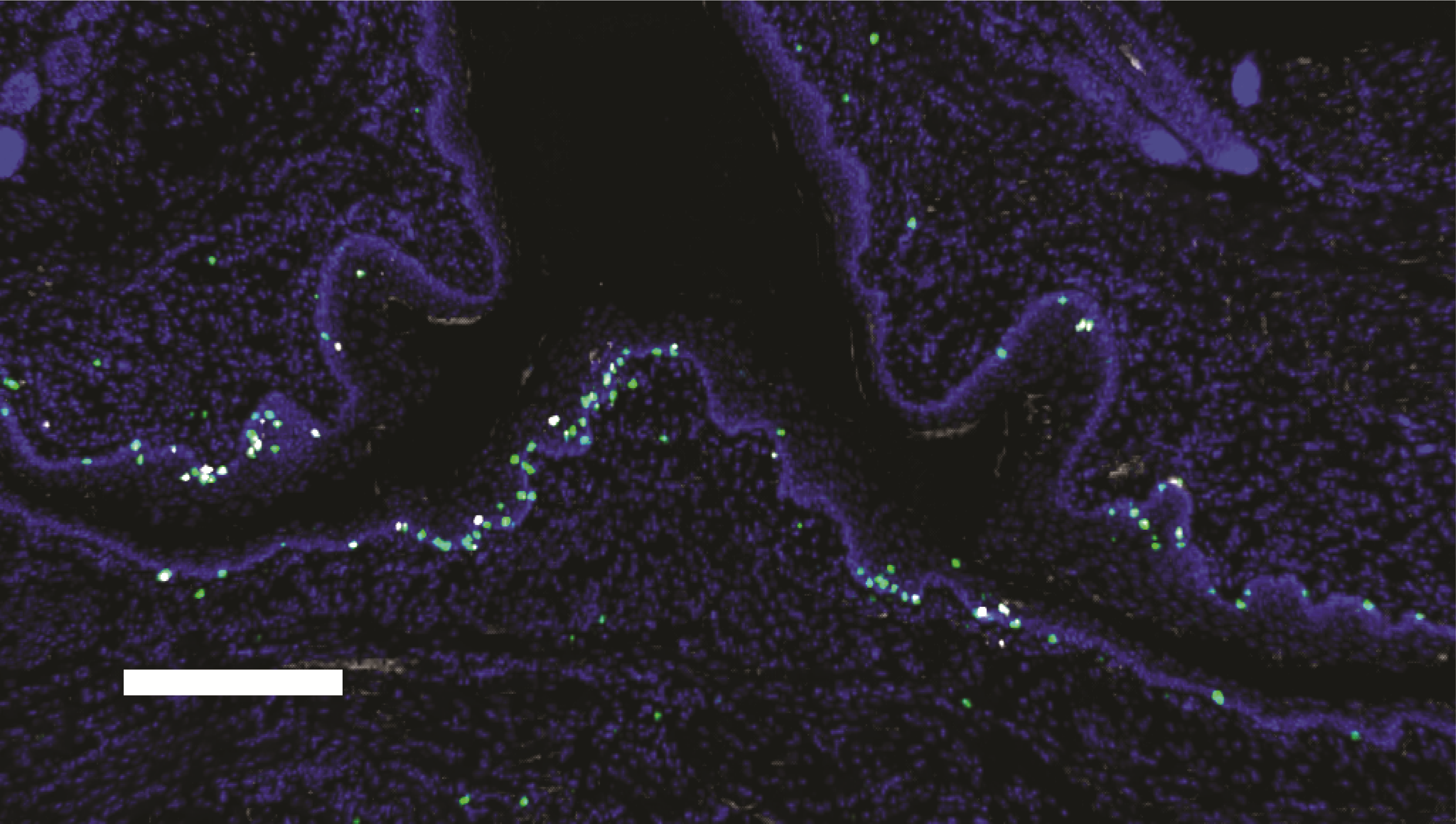 Cytotoxic group I innate lymphoid cells populate the murine oral mucosa.