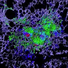 Mycobacterium Tuberculosis 