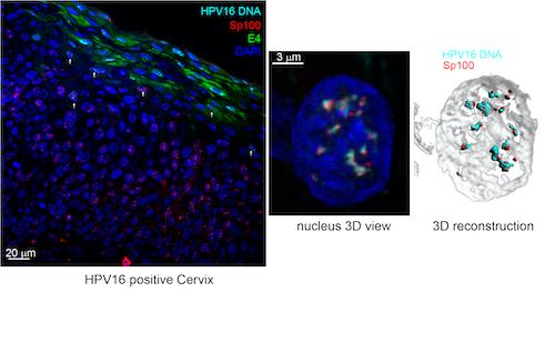 Images of the Sp100 protein and scans showing viral replication foci.