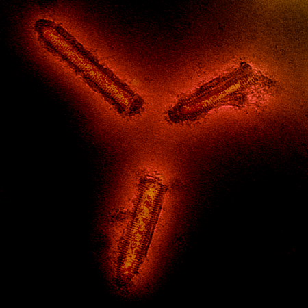 Electron micrograph of vesicular stomatitis virus.