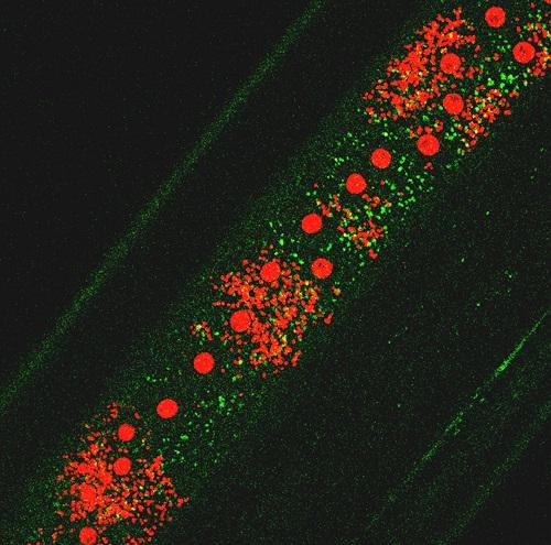 Wolbachia induce Autophagy in Brugia malayi. Green: autophagosomal protein; small red dots: Wolbachia; red spots: worms nuclei.