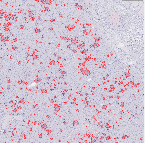 Immunohistochemical stain for viral glycoprotein in liver slide