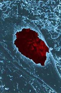 Scanning micrograph of a chlamydial inclusion in a fractured cell.