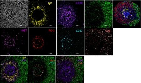 Example of multispectral confocal imaging 