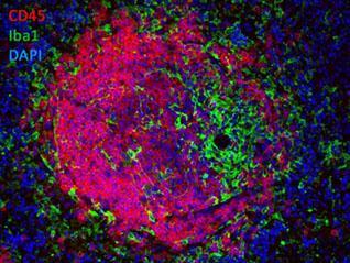 Double-Label Immunofluorescence of a Lymphoid Follicle Right