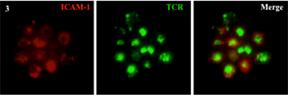 Example of live imaging and TIRF microscopy 