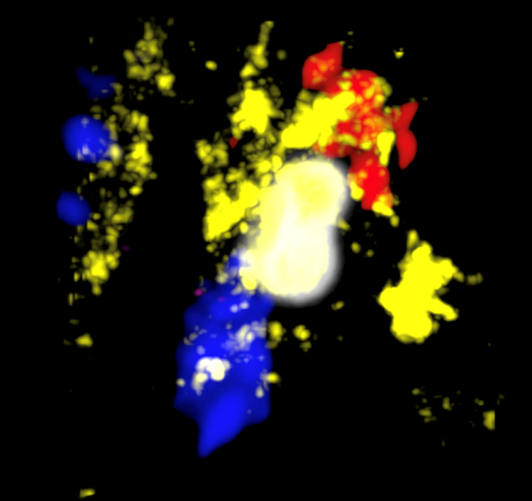 A tridimensional view of a macrophage (IBA-1, yellow; DAPI, blue) from mouse skin expressing heme oxygenase-1 (HO-1, red) after ingesting a red blood cell (TER-119, white) 18 hours after sand fly bites.