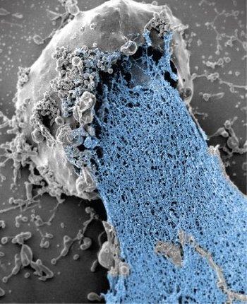 Formation of a neutrophil extracellular trap.