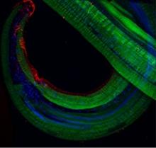 Surface expression of a filarial parasite-encoded molecule