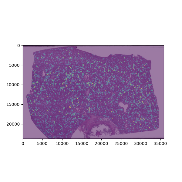 Clustering analysis based on morphologic features of necrotic areas in liver slide from viral infection