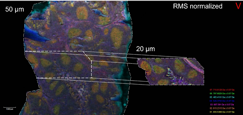 Tissue Mass Spectrometry Imaging