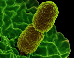 Colorized scanning electron micrograph showing carbapenem-resistant Klebsiella pneumoniae interacting with a human neutrophil