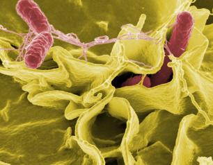 Salmonella bacteria (pink), a common cause of foodborne disease, invade a human epithelial cell.