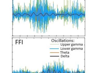 This image shows differences in brain waves, illustrating brain cell dysfunction in organoid models of fatal familial insomnia compared to controls.