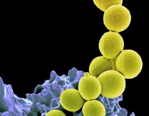 Methicillin-resistant Staphylococcus aureus bacteria (yellow) being ingested by neutrophil (purplish blue). 